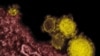 Foreign Doctors, Nurses in Saudi Arabia Could Take MERS Global