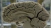 Belief About Source of Intelligence Affects Effort