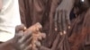 Hands of people handicapped by leprosy, Yaounde, Jan. 21, 2021. (Moki Edwin Kindzeka/VOA)