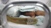 Studi Baru Kaitkan Kelahiran Prematur dengan Mikroba di Tubuh Ibu